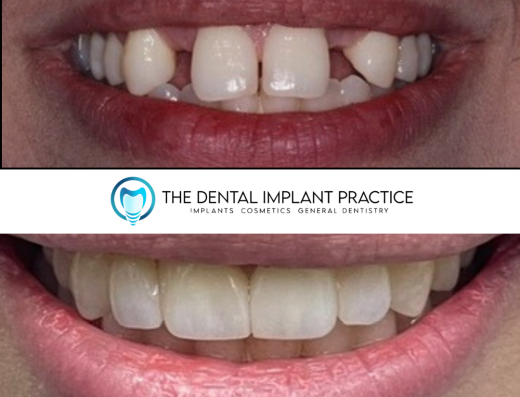 THE DENTAL IMPLANT PRACTICE