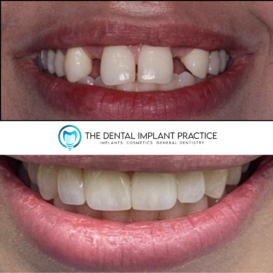 THE DENTAL IMPLANT PRACTICE