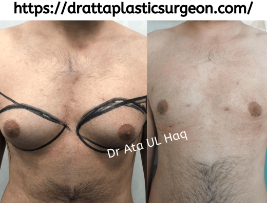 Dr Atta Plastic Surgeon