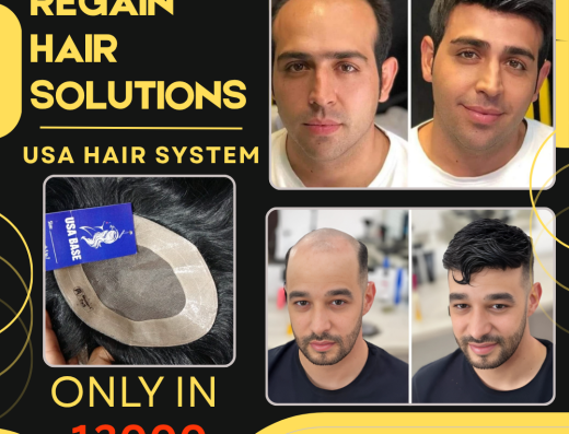 Regain Hair Solutions