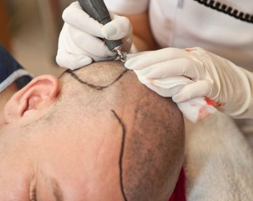 Dr Atta Plastic Surgeon